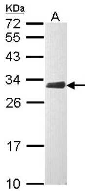 Western Blot: CLIC4 Antibody [NBP1-33474]