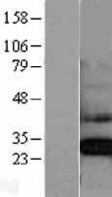 Western Blot: CLIC4 Overexpression Lysate [NBL1-09269]