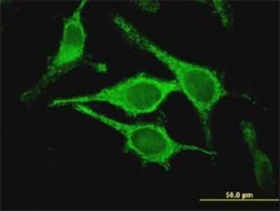 Immunocytochemistry/ Immunofluorescence: CLIC5 Antibody (1E6) [H00053405-M03]