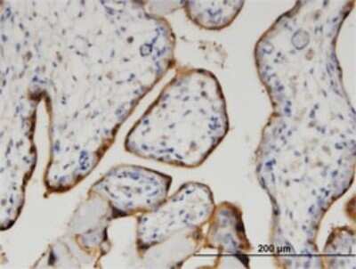 Immunohistochemistry-Paraffin: CLIC5 Antibody (1E6) [H00053405-M03]