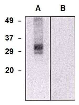 Western Blot: CLIC5 Antibody (CLIC5-02) [NBP2-62197]