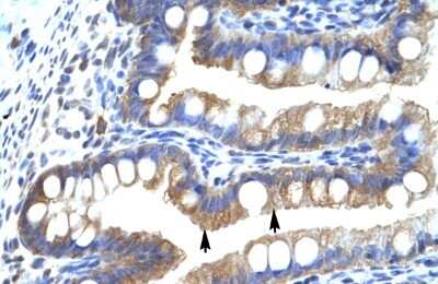 Immunohistochemistry-Paraffin: CLIC5 Antibody [NBP1-80075]