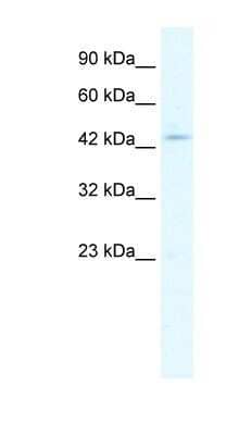 Western Blot: CLIC5 Antibody [NBP1-80075]