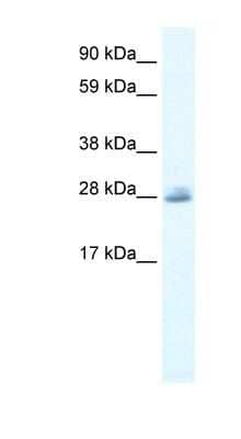 Western Blot: CLIC5 Antibody [NBP1-80076]