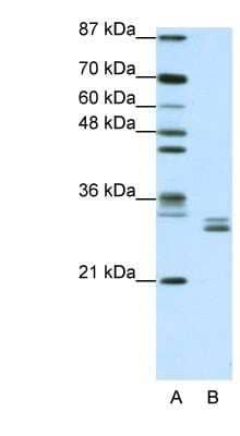 Western Blot: CLIC5 Antibody [NBP1-80077]