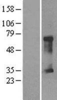 Western Blot: CLIC5 Overexpression Lysate [NBL1-09270]