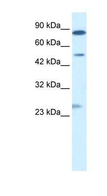 Western Blot: CLIC6 Antibody [NBP1-80089]