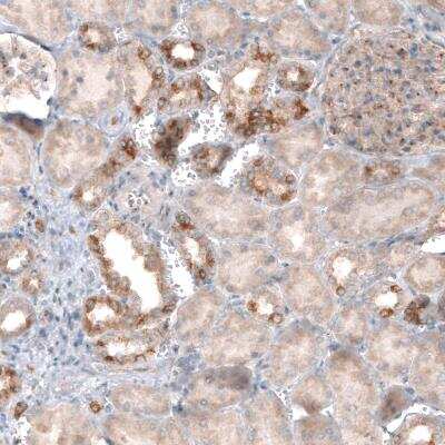 Immunohistochemistry-Paraffin: CLIP170 Antibody (CL4844) [NBP2-61143]