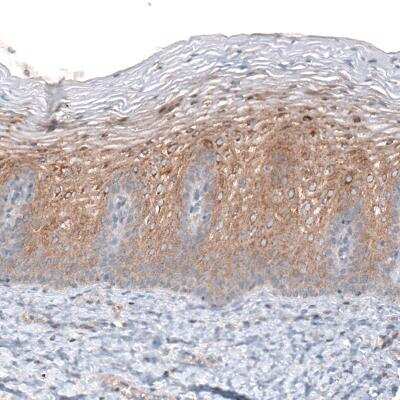 Immunohistochemistry-Paraffin: CLIP170 Antibody (CL4844) [NBP2-61143]