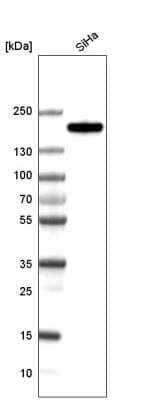 Western Blot: CLIP170 Antibody (CL4844) [NBP2-61143]