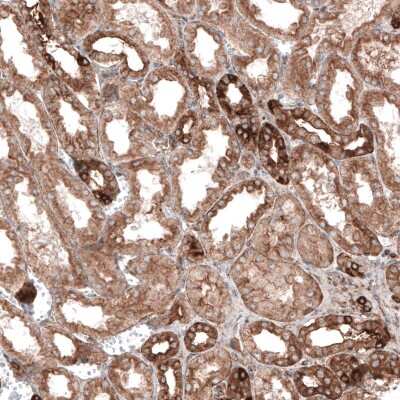 Immunohistochemistry-Paraffin: CLIP170 Antibody (CL4851) [NBP2-61144]