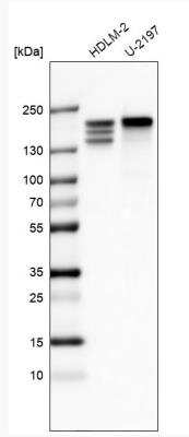 Western Blot: CLIP170 Antibody (CL4851) [NBP2-61144]