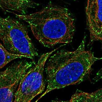 Immunocytochemistry/ Immunofluorescence: CLIP170 Antibody [NBP1-85568]