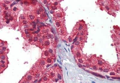 Immunohistochemistry-Paraffin: CLIP170 Antibody [NBP1-36749]