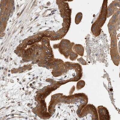 Immunohistochemistry-Paraffin: CLIP170 Antibody [NBP1-85568]