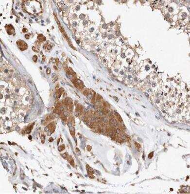Immunohistochemistry-Paraffin: CLIP170 Antibody [NBP1-85568]