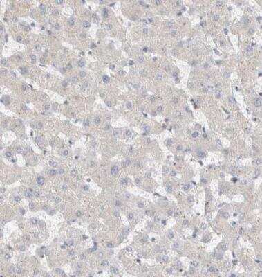 Immunohistochemistry-Paraffin: CLIP170 Antibody [NBP1-85568]