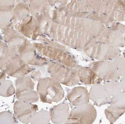 Immunohistochemistry-Paraffin: CLIP170 Antibody [NBP1-85568]