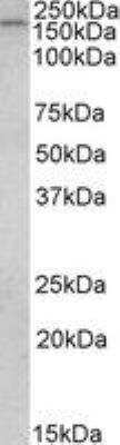 Western Blot: CLIP170 Antibody [NBP1-36749]