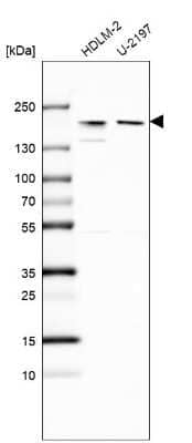 Western Blot: CLIP170 Antibody [NBP1-85568]