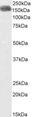 Western Blot: CLIP170 Antibody [NBP2-75095]