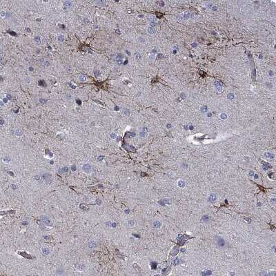 Immunohistochemistry-Paraffin: CLIP3 Antibody [NBP3-17101]