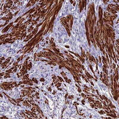 Immunohistochemistry-Paraffin: CLIP4 Antibody [NBP1-91793]