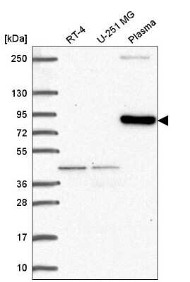 Western Blot: CLIP4 Antibody [NBP2-55452]