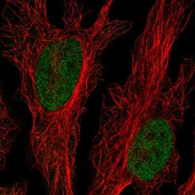 Immunocytochemistry/ Immunofluorescence: CLK2 Antibody [NBP2-56937]