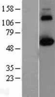 Western Blot: CLK2 Overexpression Lysate [NBL1-09274]