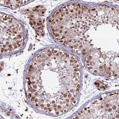 Immunohistochemistry-Paraffin: CLK3 Antibody [NBP1-91794]