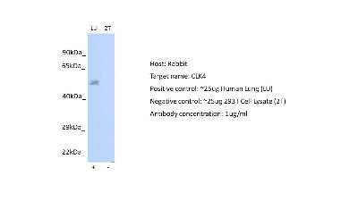 Western Blot: CLK4 Antibody [NBP2-87195]