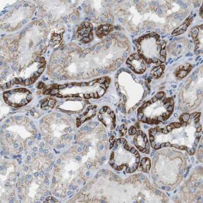 Immunohistochemistry-Paraffin: CLMN Antibody [NBP1-94034]