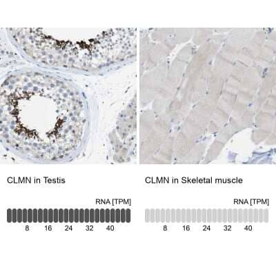 Immunohistochemistry-Paraffin: CLMN Antibody [NBP1-94034]