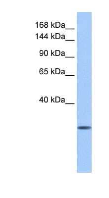 Western Blot: CLMN Antibody [NBP1-91449]