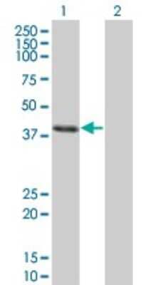 Western Blot: CLN3 Antibody (1G10) [H00001201-M03]