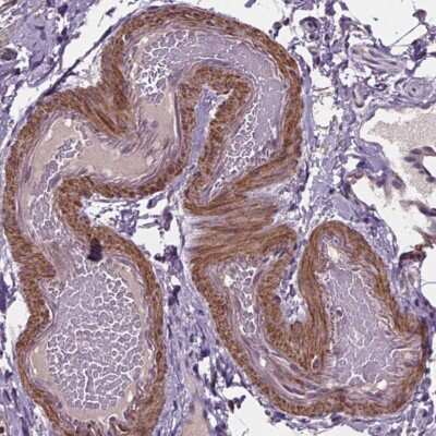 Immunohistochemistry: CLN3 Antibody [NBP2-49391]