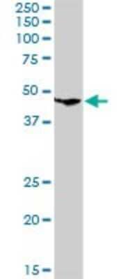 Western Blot: CLN3 Antibody [H00001201-D01P]