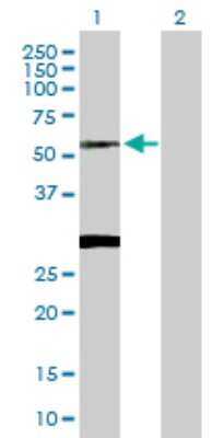 Western Blot: CLN3 Antibody [H00001201-D01P]