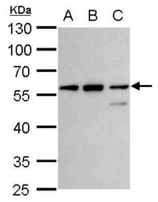 Western Blot: CLN3 Antibody [NBP2-43782]