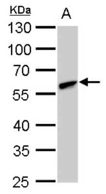 Western Blot: CLN3 Antibody [NBP2-43782]