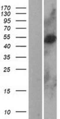 Western Blot: CLN3 Overexpression Lysate [NBP2-04147]