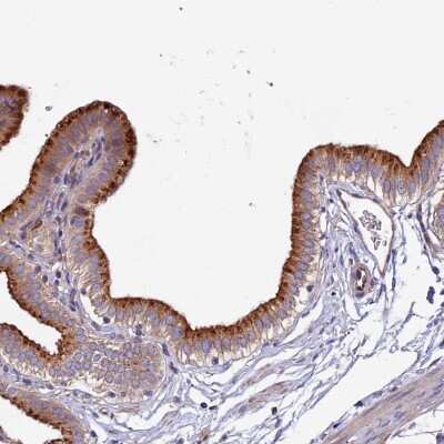 Immunohistochemistry-Paraffin: CLN5 Antibody [NBP1-94150]