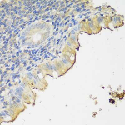Immunohistochemistry-Paraffin: CLN5 Antibody - Azide and BSA Free [NBP2-92707]