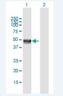 Western Blot: CLN5 Antibody [H00001203-B01P-50ug]