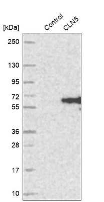 Western Blot: CLN5 Antibody [NBP1-94150]