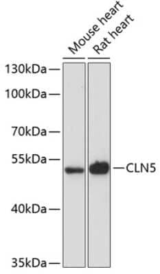 Western Blot: CLN5 AntibodyAzide and BSA Free [NBP2-92707]