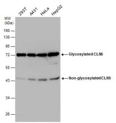 Western Blot: CLN5 Antibody [NBP3-12971]