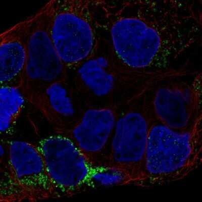 Immunocytochemistry/ Immunofluorescence: CLN6 Antibody [NBP2-56415]