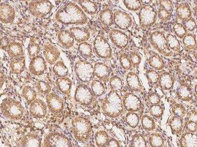 Immunohistochemistry-Paraffin: CLN6 Antibody [NBP3-05809]